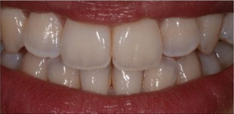 After image