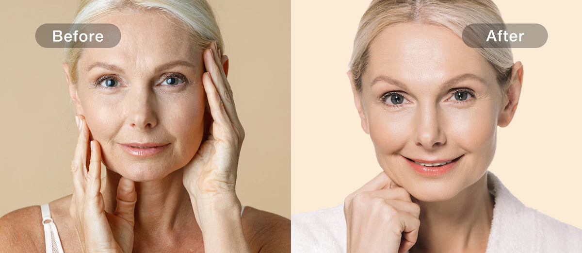 Glow before and after comparison