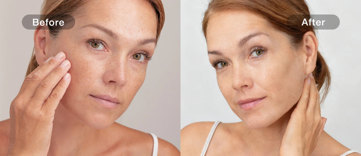 Spots before and after comparison