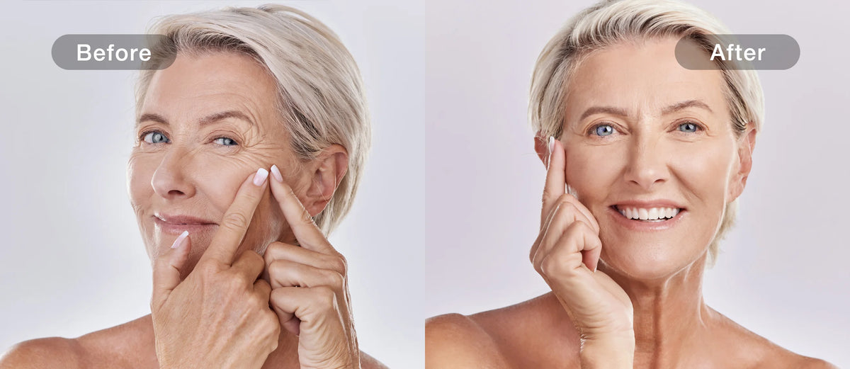 Firming before and after comparison