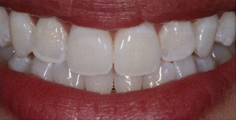 Before image