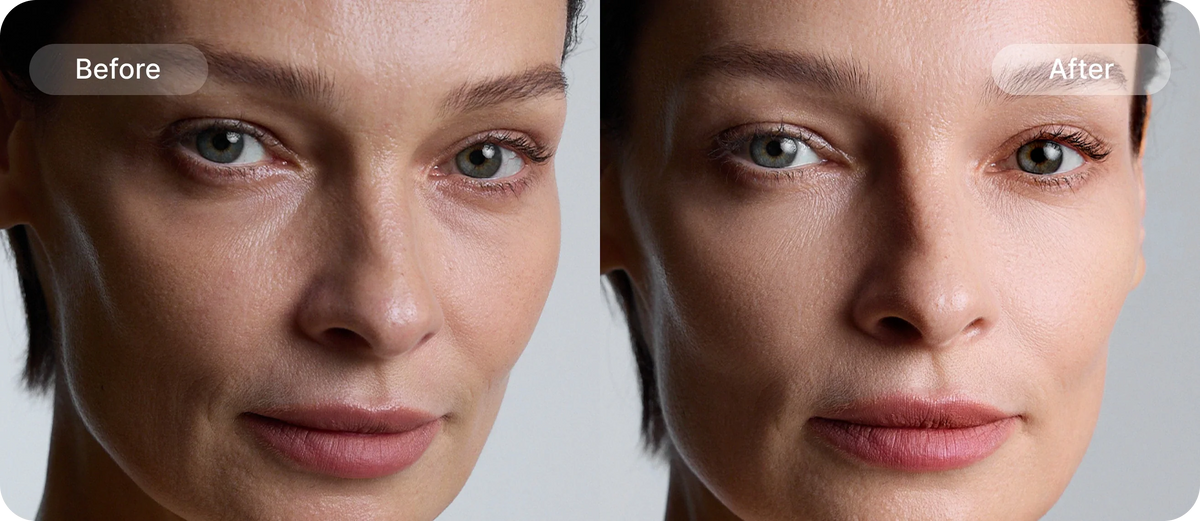 Wrinkle before and after comparison